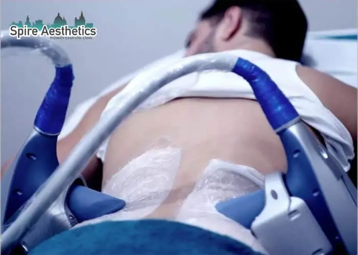 Man having fat freezing treatment done on love handles before a competitions Henley In Arden to create a sculpted look.