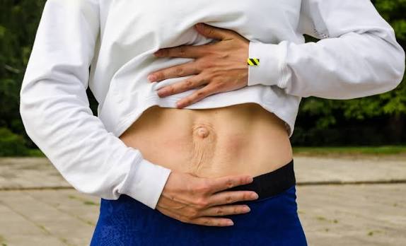 When Could Diastasis Recti Be the Missing Piece of the Puzzle Henley In Arden?
